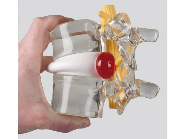 [2250] Simulador Hernia Discal